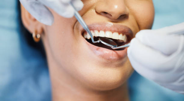 Best Emergency Tooth Extraction in Ironwood, MI